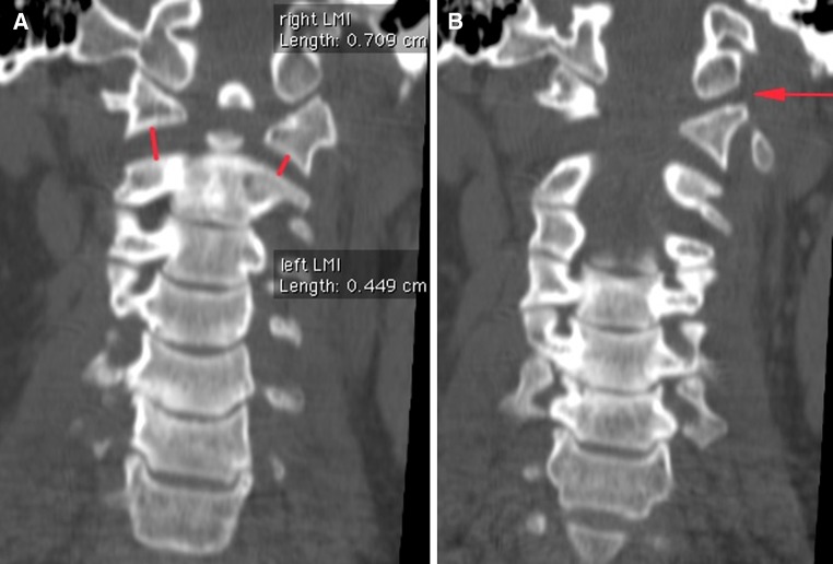 Fig. 3