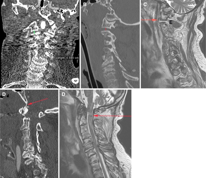 Fig. 2