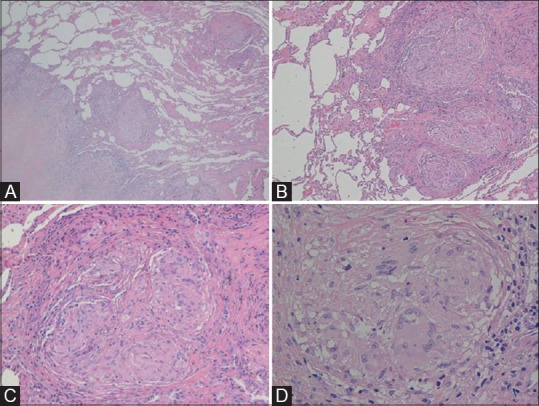 Figure 2(A-D)