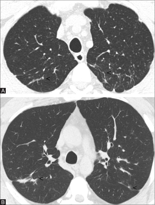 Figure 3(A and B)