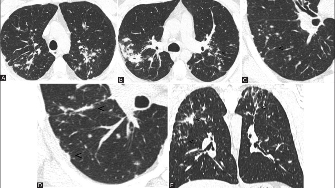 Figure 1(A-E)