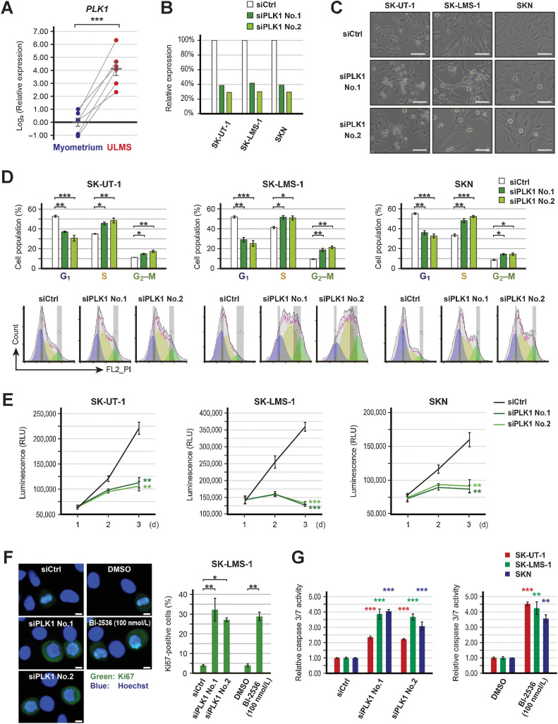 Figure 3. Effects of PLK1 silencing. A, The relative expression of PLK1 in paired ULMS and myometrium. ACTB was used as a reference gene to normalize expression, and the relative expression was compared using the paired t test. B, Validation of PLK1 suppression following transfection with 3 nmol/L of siRNA for PLK1 (siPLK1). C, The representative images of siPLK1 transfected cells; scale bars, 100 µm. D, Cell-cycle distribution of siPLK1 transfected cells. Cell-cycle distribution was calculated by FlowJo. The experiments were performed in three independent replicates and the percentage of cells was compared using the Dunnett's test. E, The proliferation of siPLK1-transfected cells. Cell viability was measured at 24, 48, and 72 hours. Experiments were performed in triplicate and repeated three times. The luminescence was compared using the Dunnett's test. F, Immunofluorescent of Ki67 in SK-LMS-1 cells treated with PLK1 inhibition. Cells were treated with PLK1 inhibition for 24 hours. The experiments were performed in three independent replicates. The percentage of Ki67-positive cells was compared using Welch's t or Dunnett's tests. The green and blue colors indicate Ki67 and Hoechst, respectively, and scale bars, 10 µm. G, The relative caspase 3/7 activity in cells treated with PLK1 inhibition. Caspase 3/7 activity was measured after 48 hours treatment. Experiments were performed in triplicate and repeated three times. The luminescence was compared using Welch's t or Dunnett's tests. Error bars represent standard errors of the mean, *, P < 0.05; **, P < 0.01; and ***, P < 0.001.