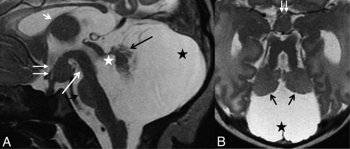 Fig 2.