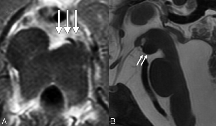 Fig 5.