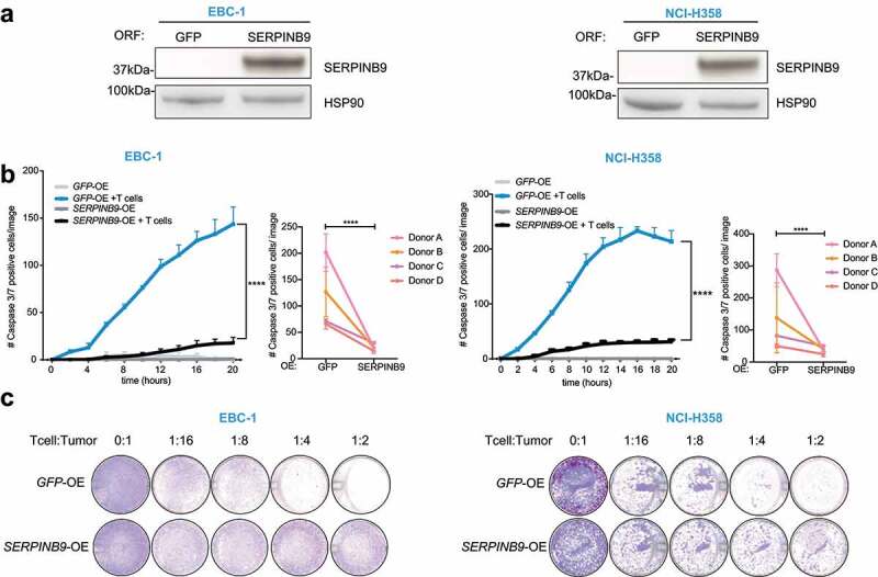 SERPINB9 is commonly amplified and high expression in cancer cells ...