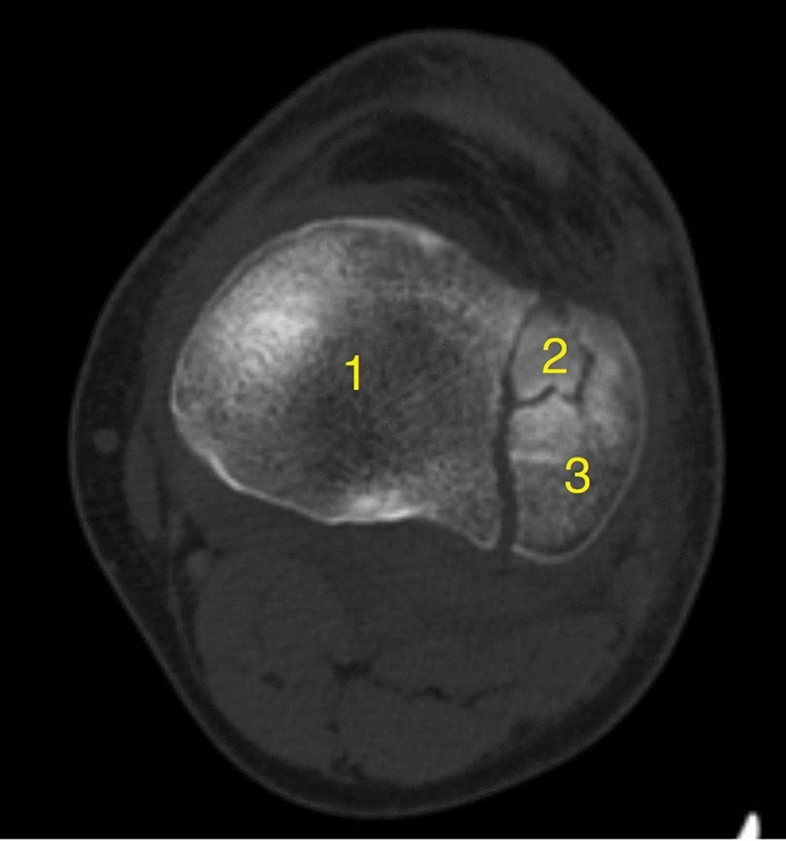 Fig. 1