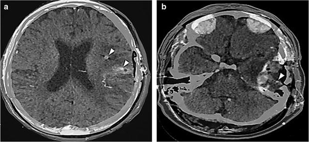 Fig. 1