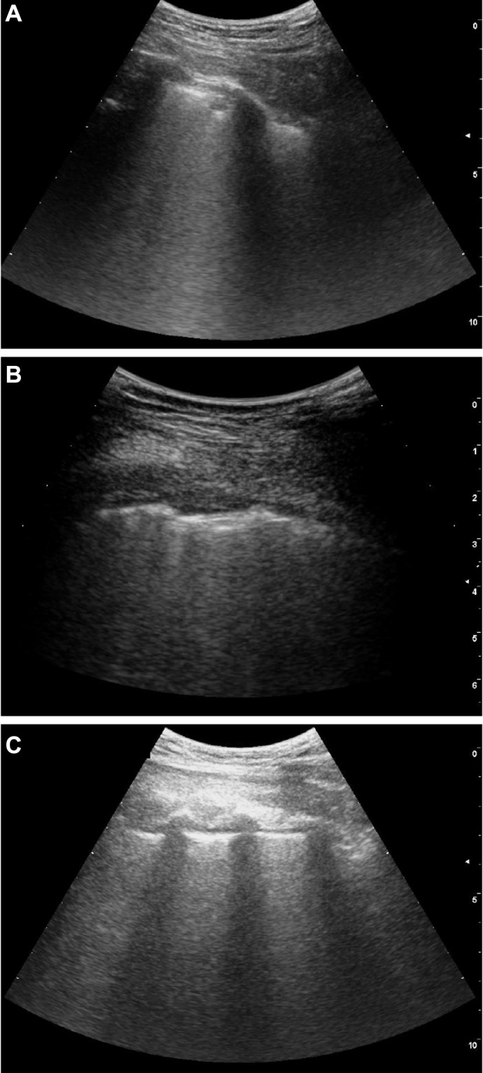 Fig. 1