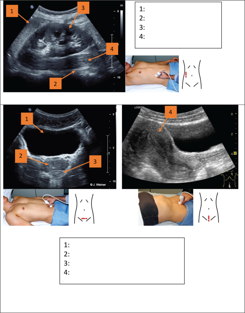 graphic file with name can-18-1722fig9.jpg