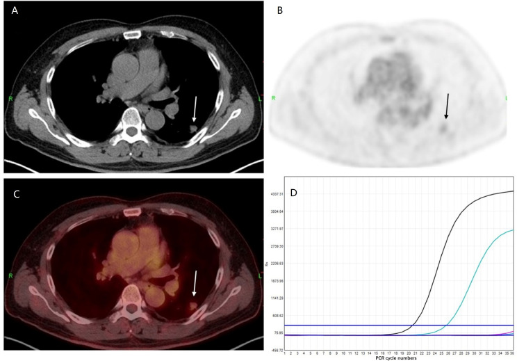 Figure 1