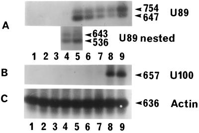 FIG. 11