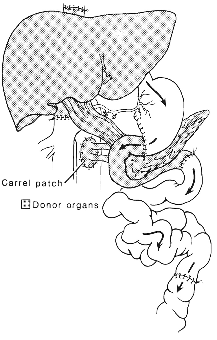 FIG. 8