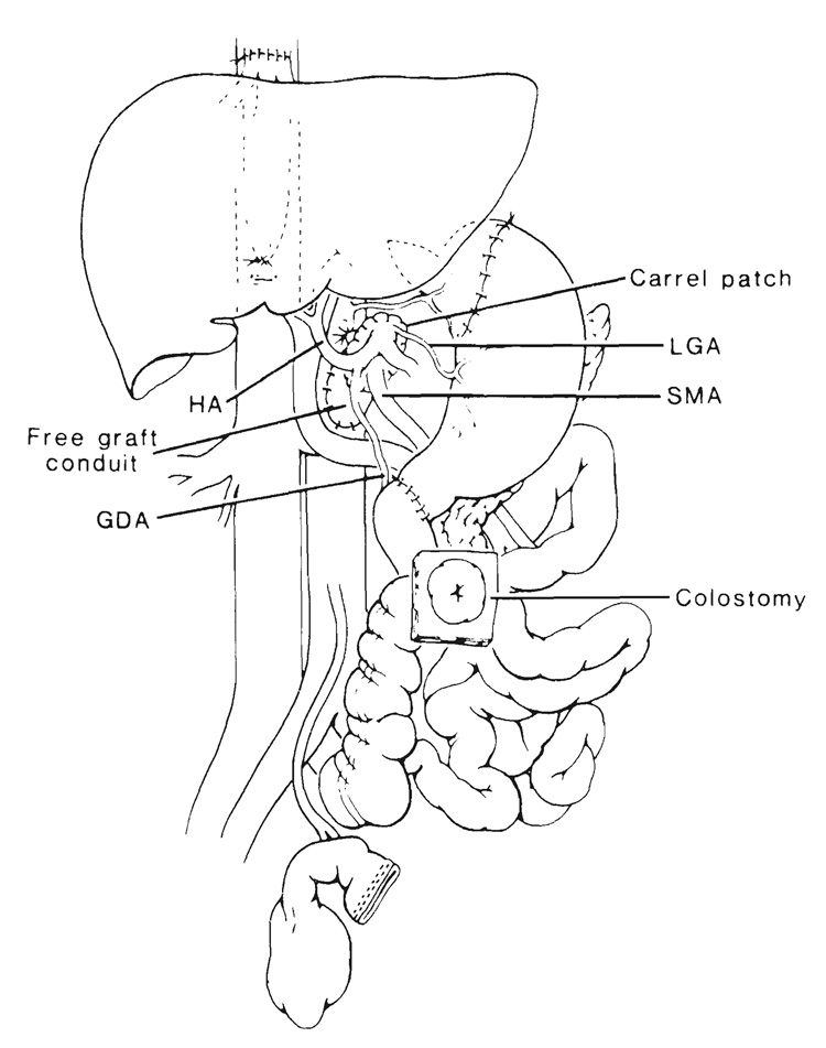 FIG. 5