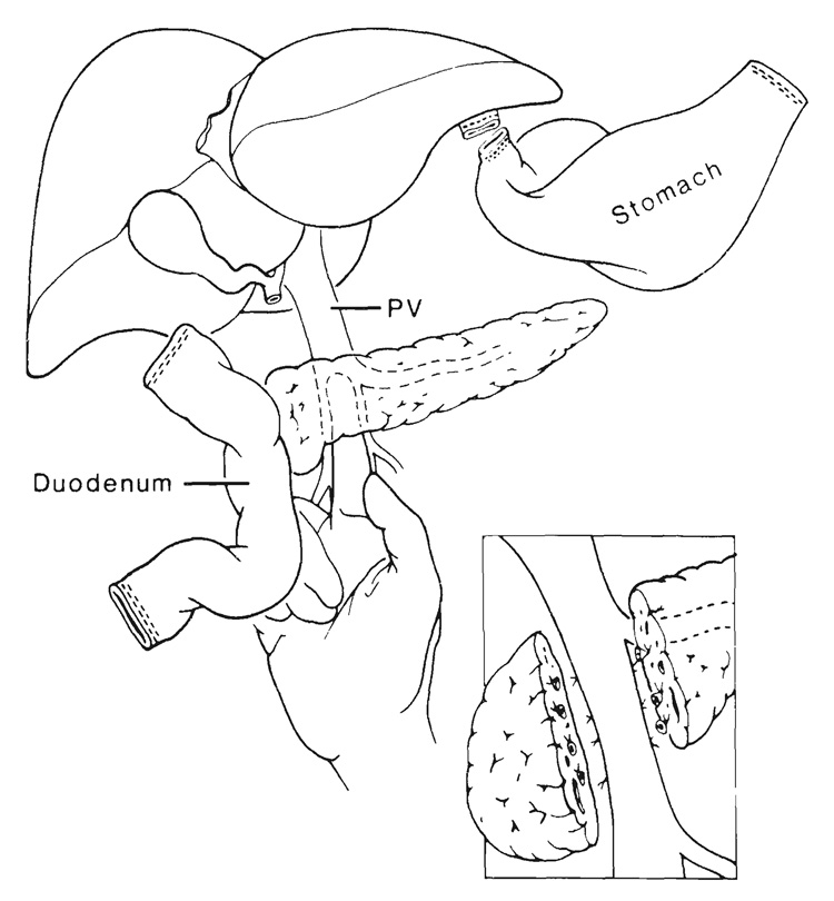 FIG. 10