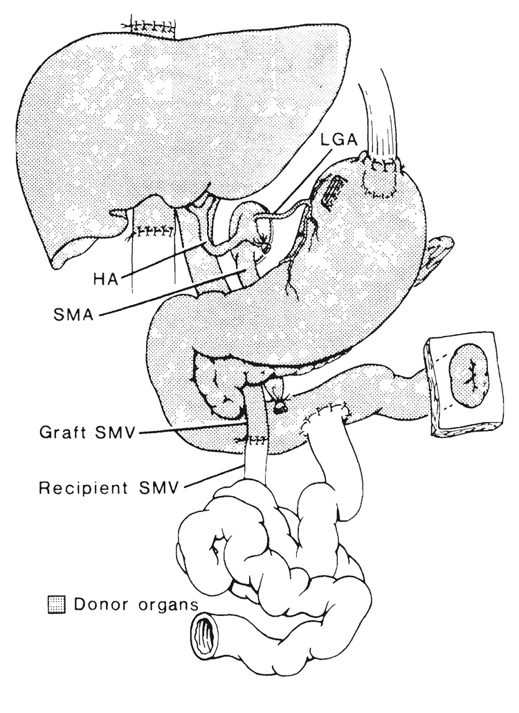 FIG. 7