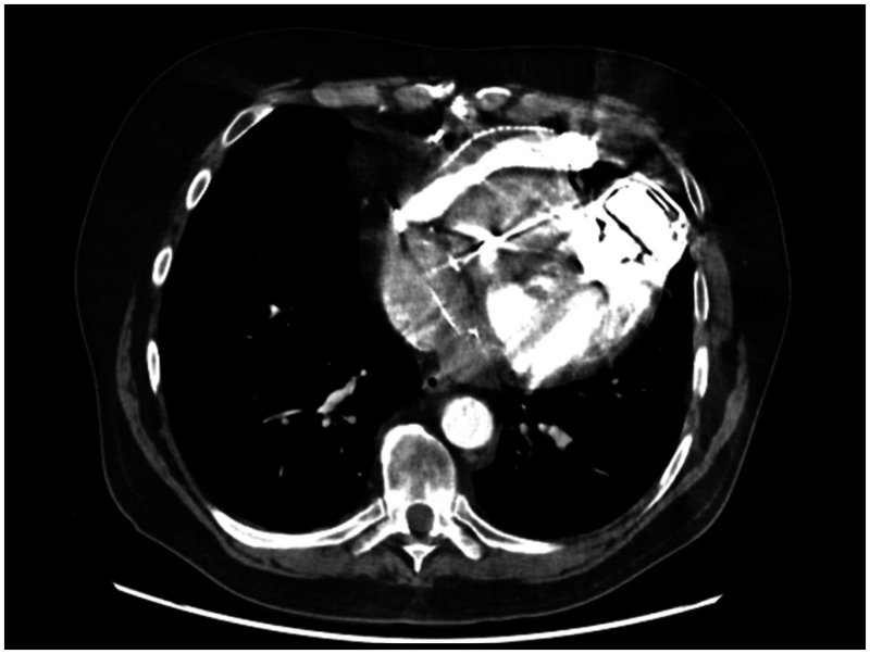 Figure 2: