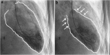<b>FIG. 1.</b>