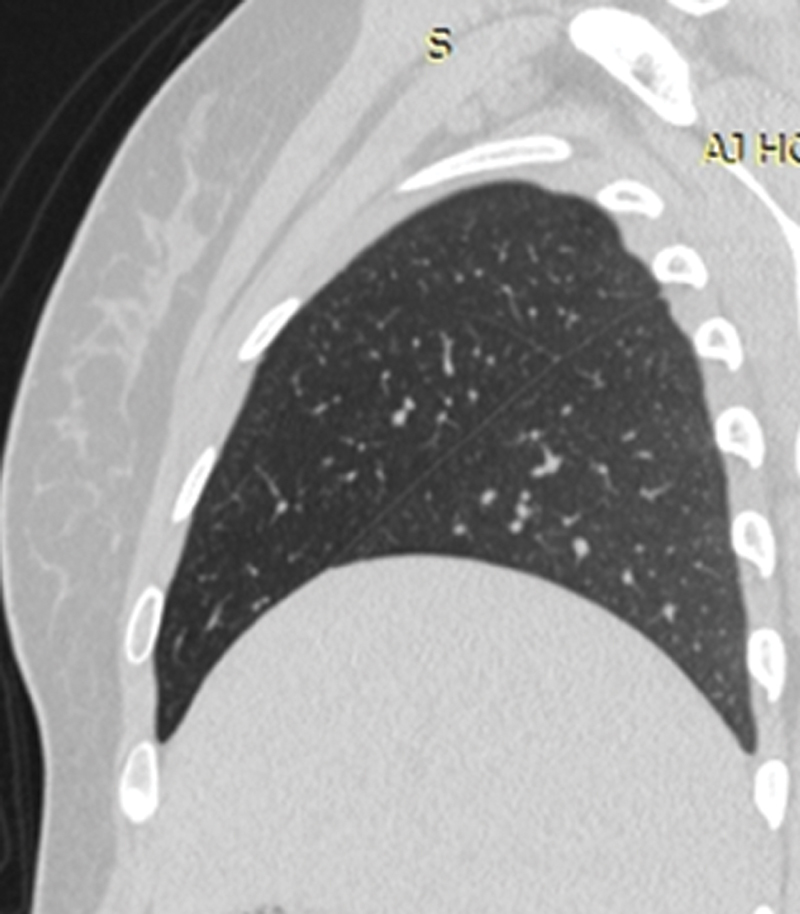 Fig. 10