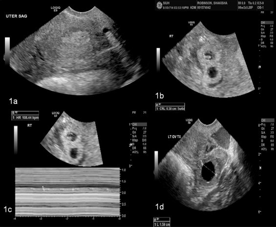 Fig. 1