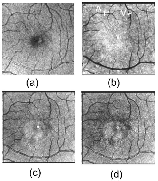 Fig. 4