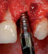 Figure 20