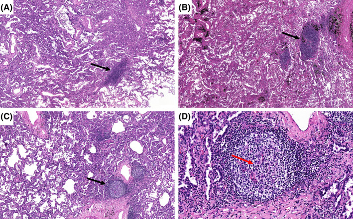 FIGURE 2