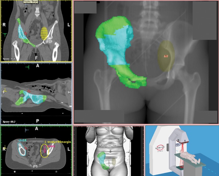 Figure 4