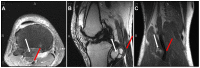 Fig 1