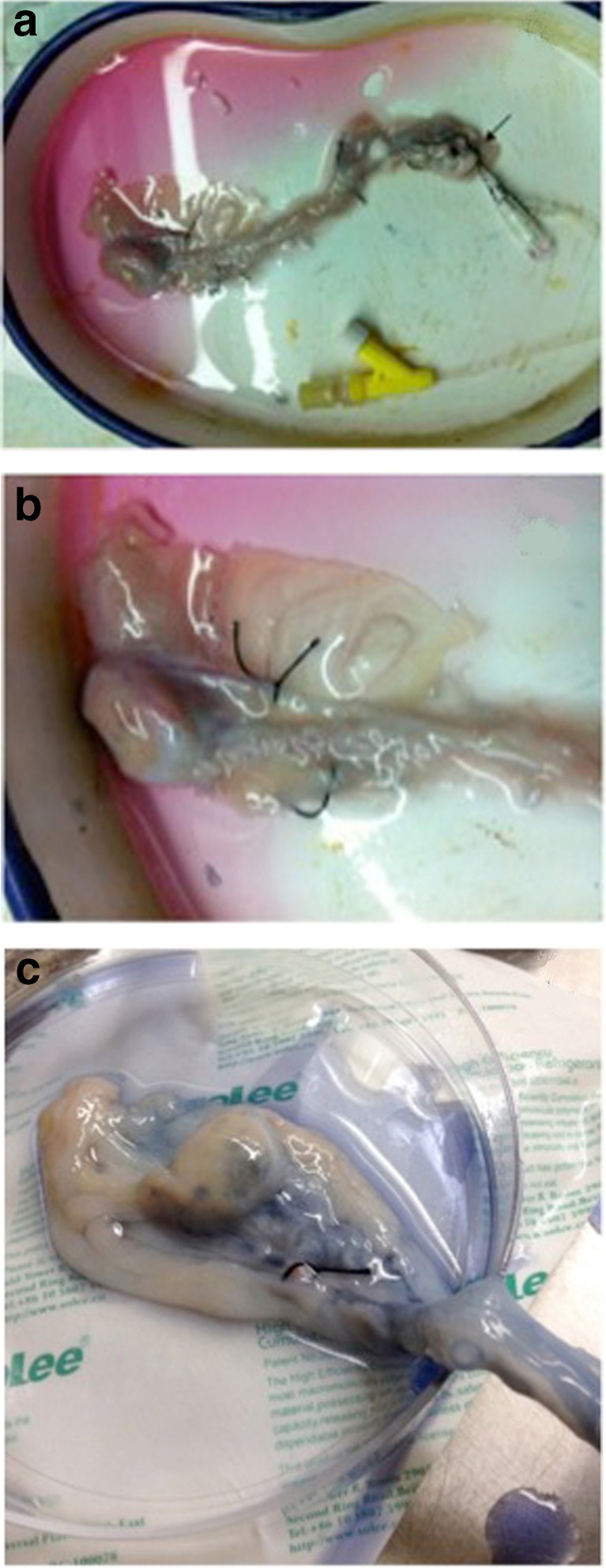 Fig. 1