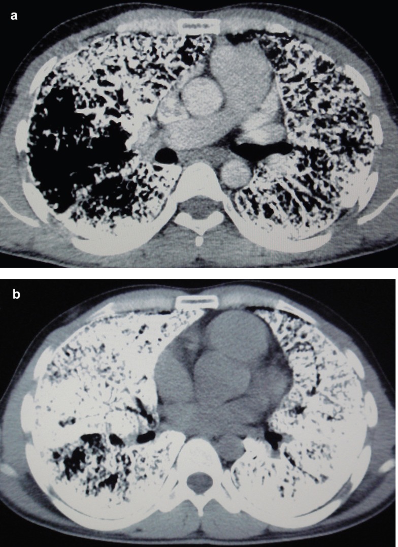 Figure 3a and 3b