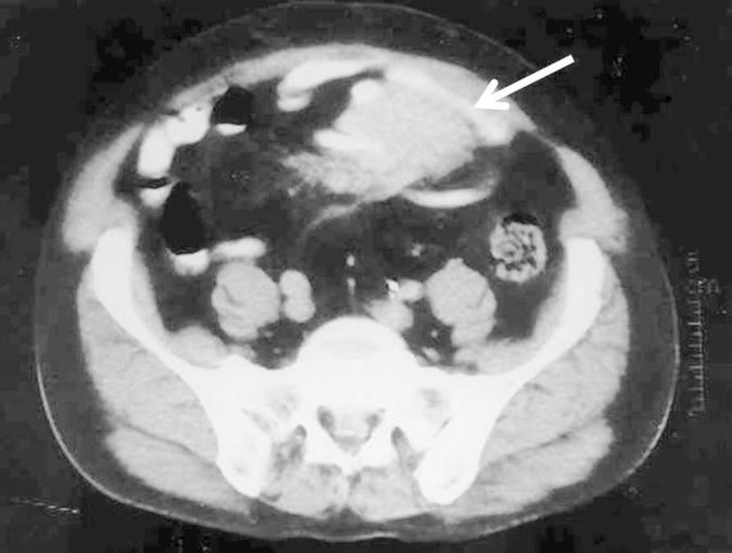 Figure 2
