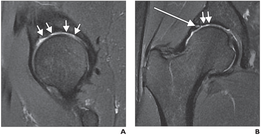 Fig. 9—