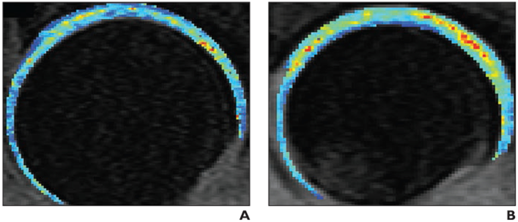 Fig. 3—