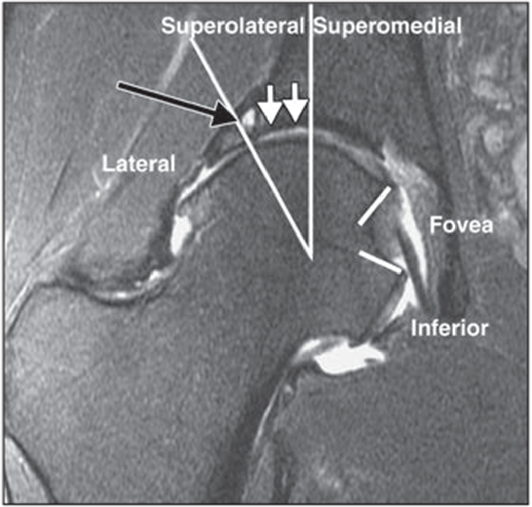 Fig. 4—