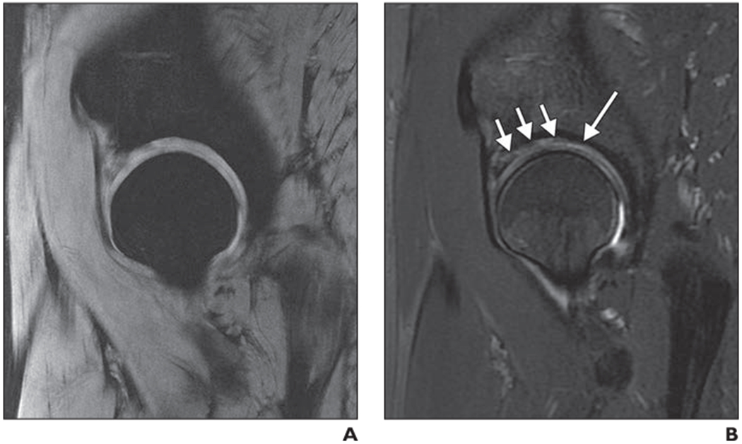 Fig. 2—