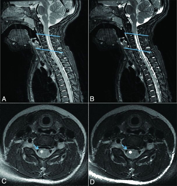 Fig 2.