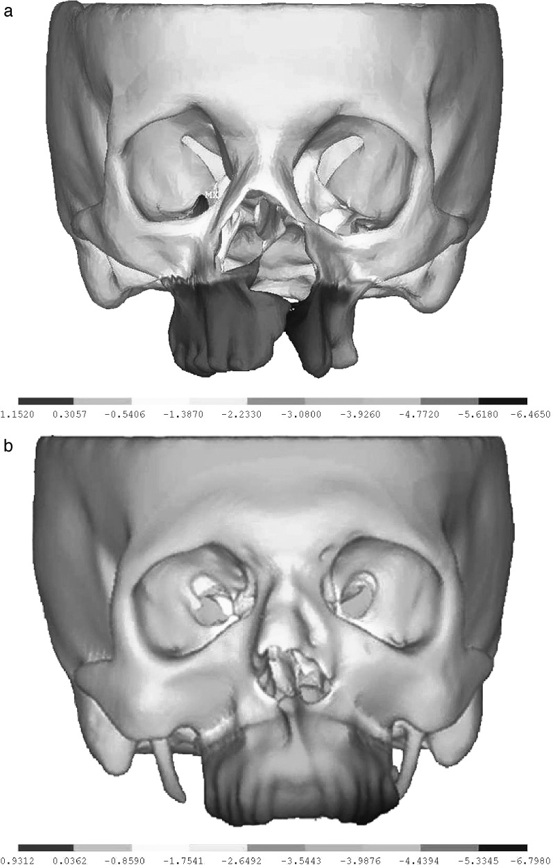 Figure 2. Displacement distribution in the sagittal plane after 6 mm of maxillary advancement. (a) for the UCLP model; and (b) for the control model.