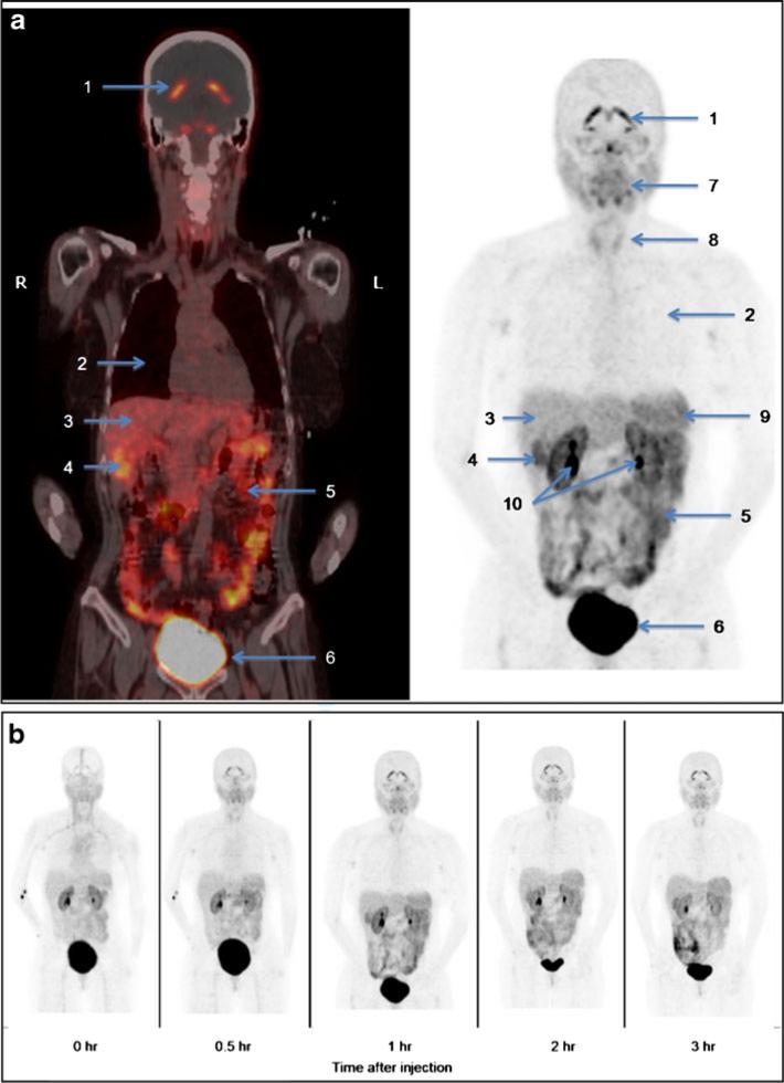 Fig. 4