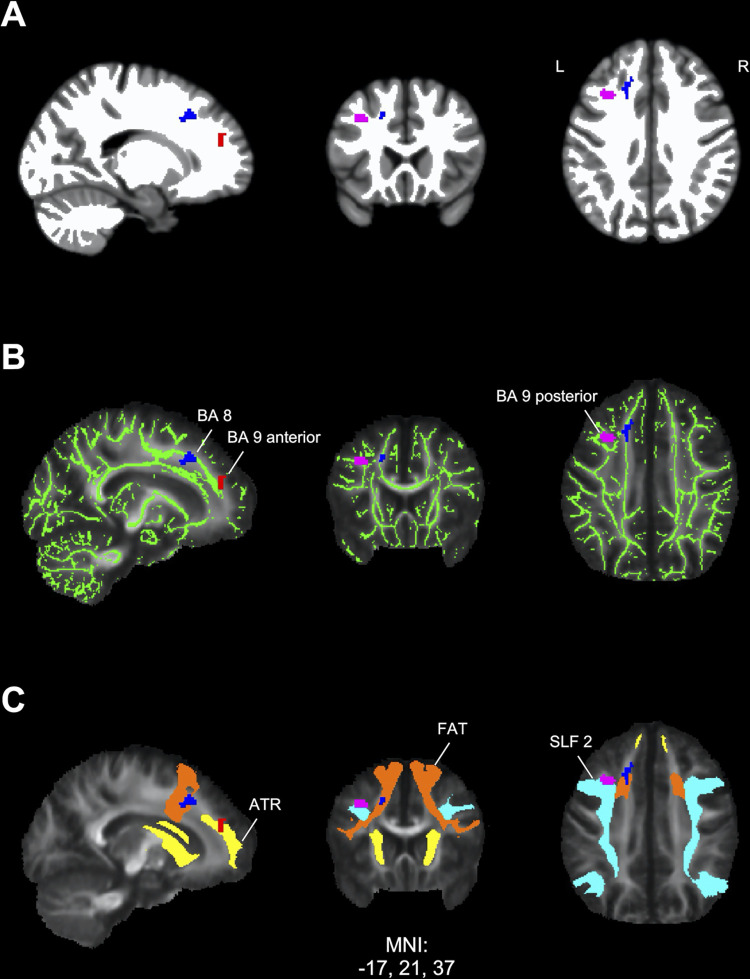 Fig 3