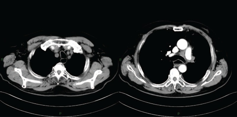 FIGURE 3