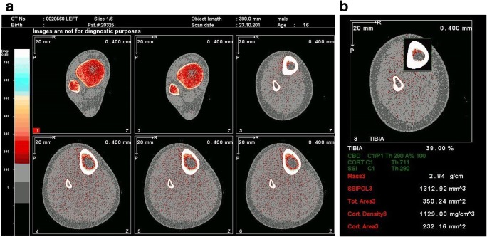 Fig. 4