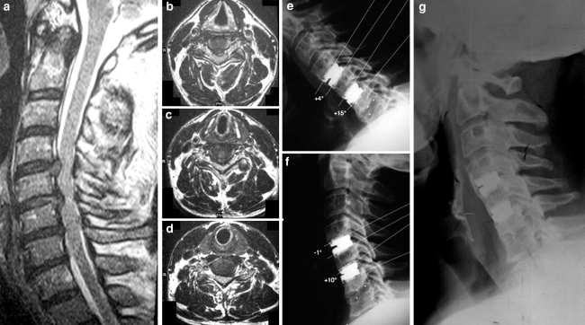 Fig. 3