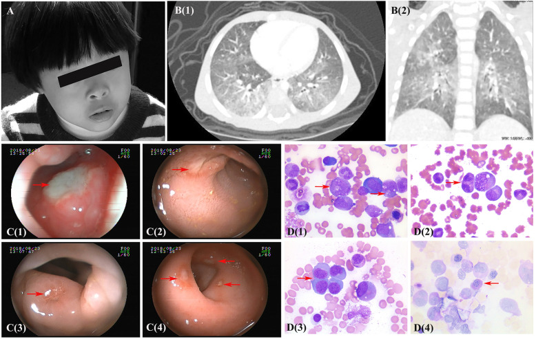 Fig. 2