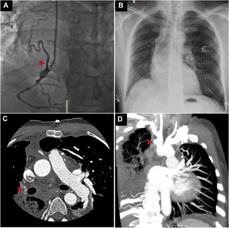 Figure 1