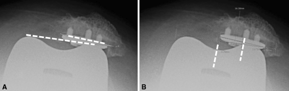 Fig. 6A–B