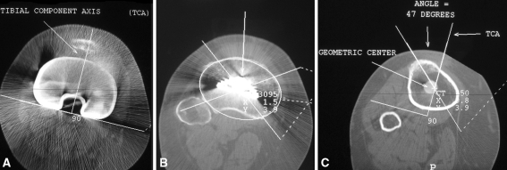 Fig. 3A–C