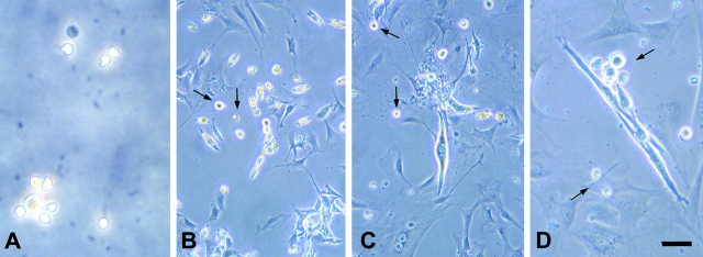 Intraarterial Injection Of Muscle-derived Cd34+sca-1+ Stem Cells 