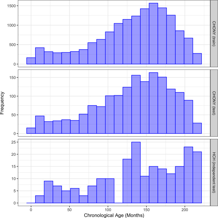 Distribution of chronological age in Children’s Hospital of New York (CHONY) training set (top), CHONY test set (middle), and Hasbro Children’s Hospital (HCH) (bottom).