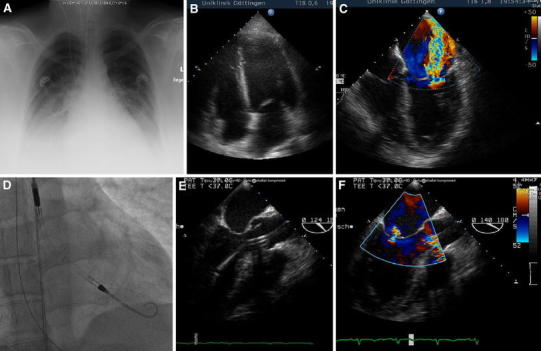 Fig. 1