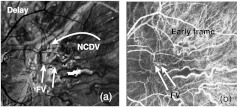 Fig. 17